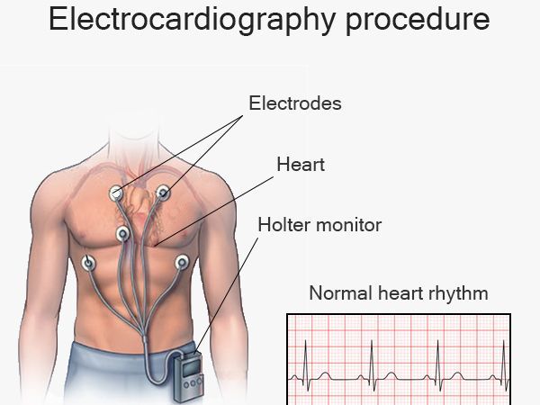 An image showcasing the Cardiology package, provided by New York Cardiac Diagnostic Center An image showcasing the Cardiology package, provided by New York Cardiac Diagnostic Center